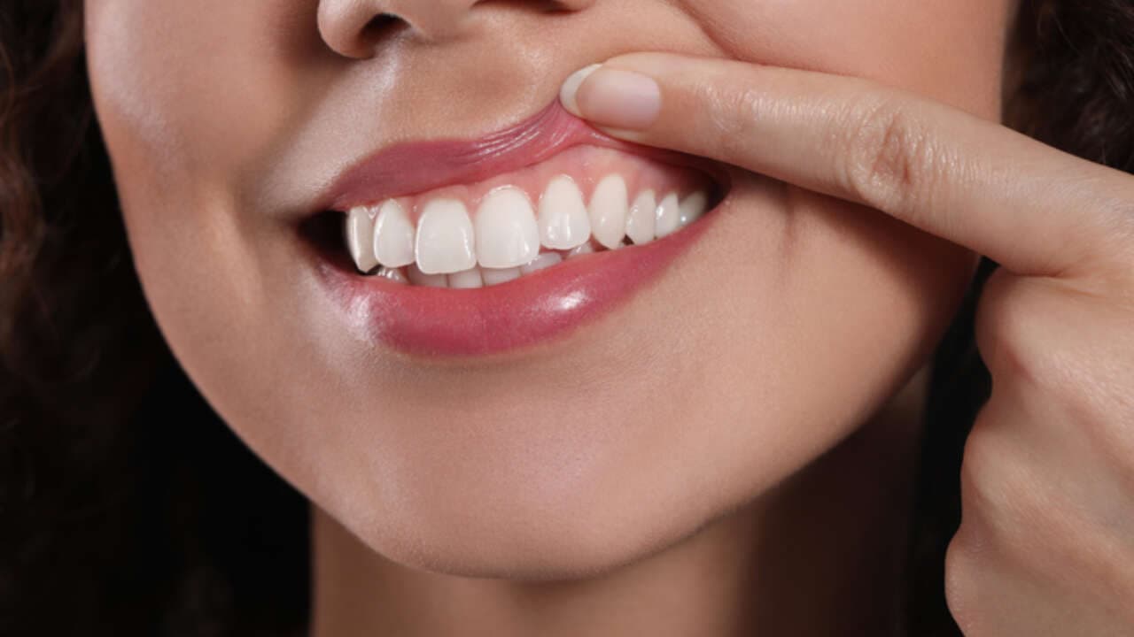 Understanding Gum Recession: Causes, Symptoms and Treatment