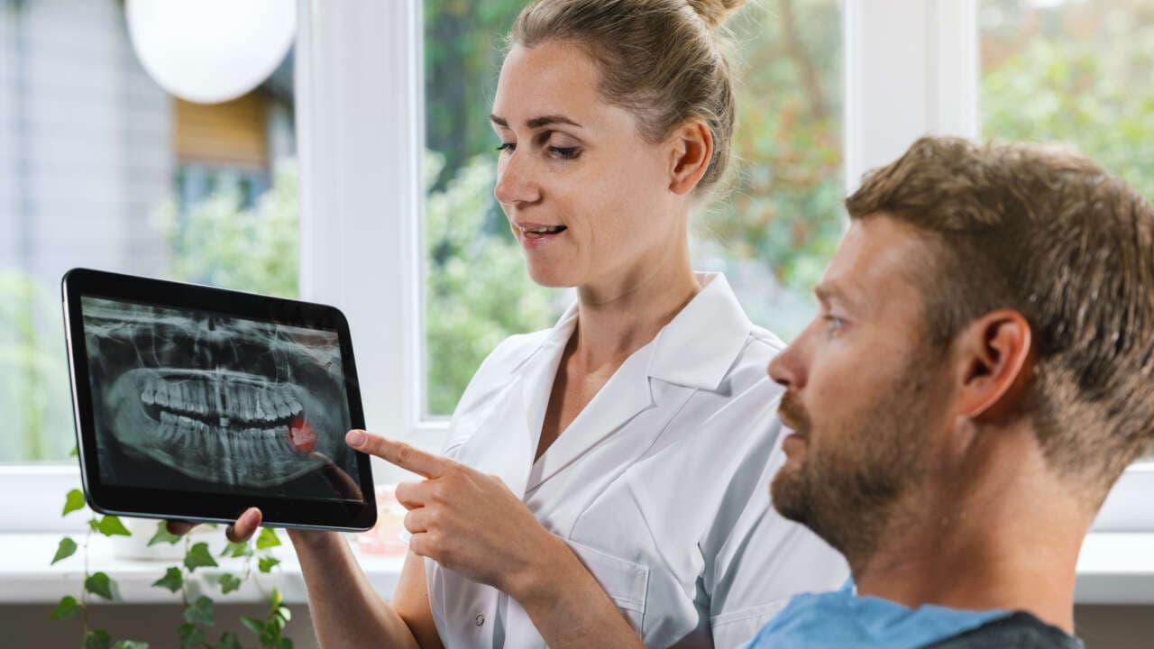 Wisdom Tooth Removal