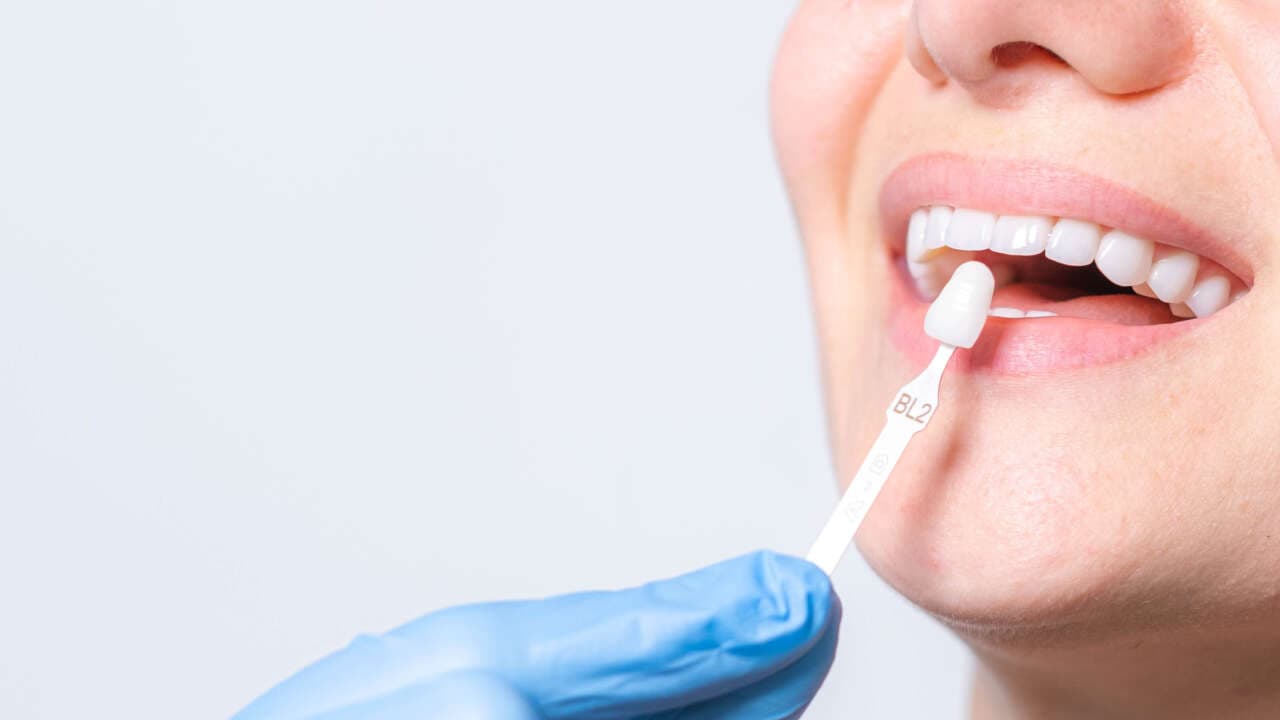 Cosmetic Dentistry